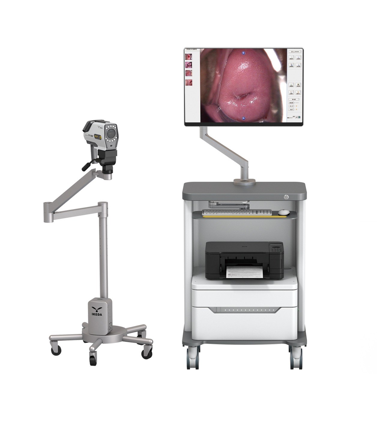 Digital colposcopy system